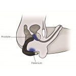 Rude Boy Dual Action Prostate Perineum Massager